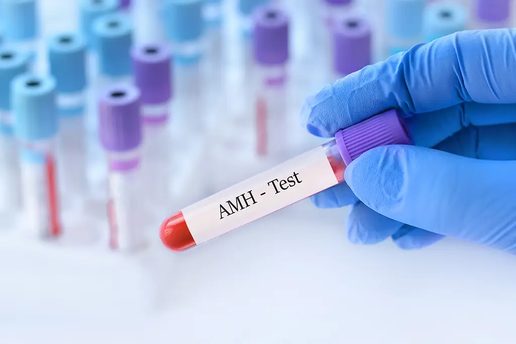 AMH Test A vital tool in accessing Fertility health copy